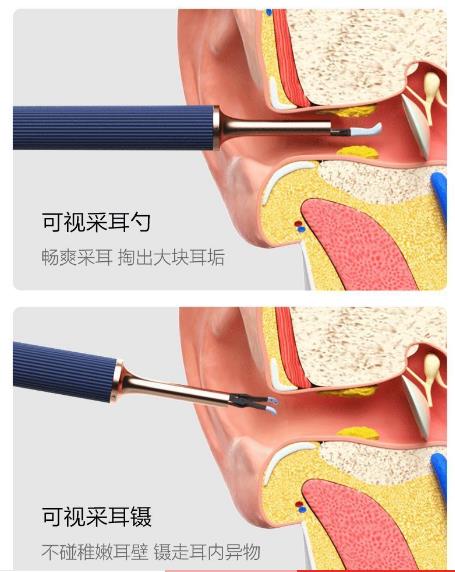 黑蜂智造bebird Note3 Pro智能可视耳勺采耳仪