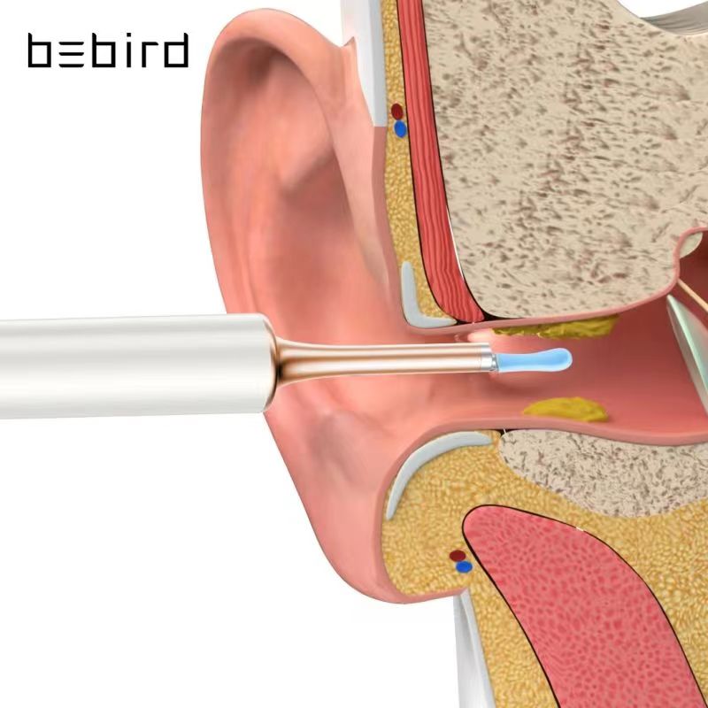 黑蜂智造bebird T5智能可视耳勺采耳棒