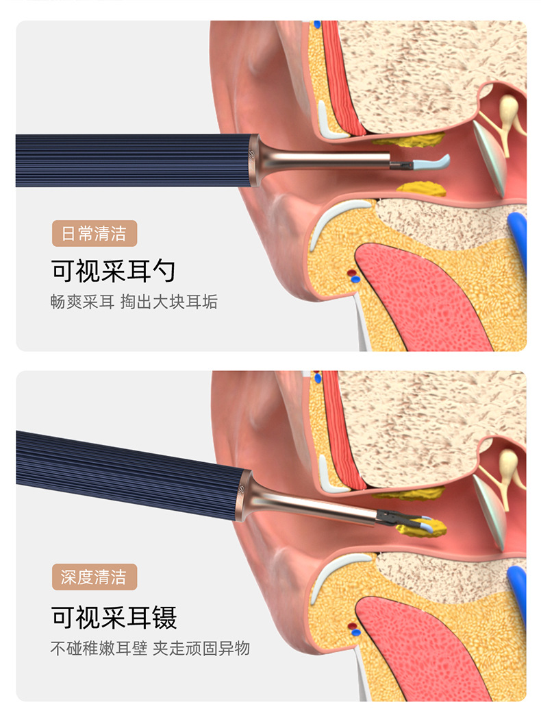 Xlife X1+可视耳勺