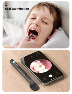 bebird可视挖耳勺蜂鸟蛇形可弯曲带镊子耳勺掏耳神器bebird3Plus